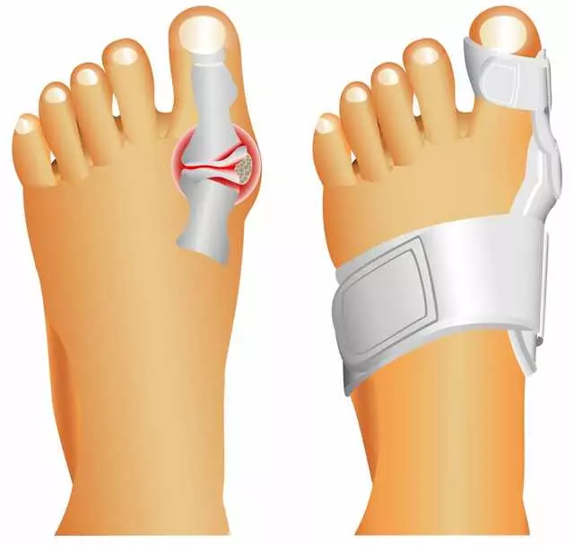 Austin Foot & Ankle Center
