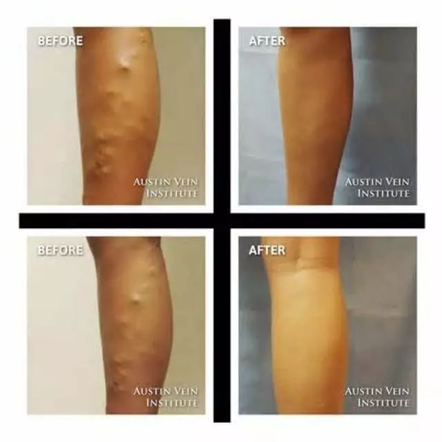 Austin Vein Institute