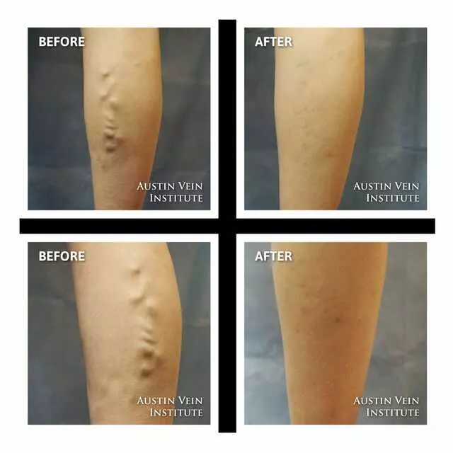 Austin Vein Institute