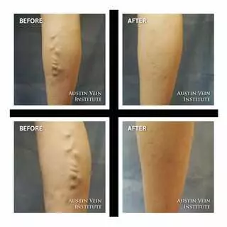 Austin Vein Institute