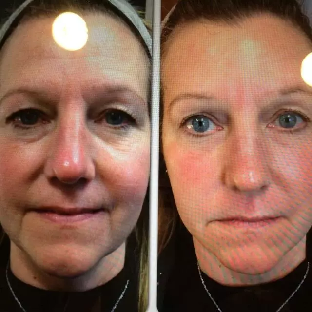 Advanced Medical Aesthetics