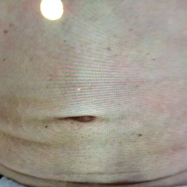 Advanced Medical Aesthetics
