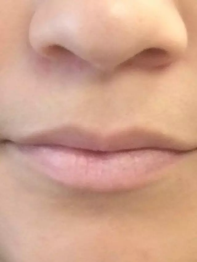 Advanced Medical Aesthetics