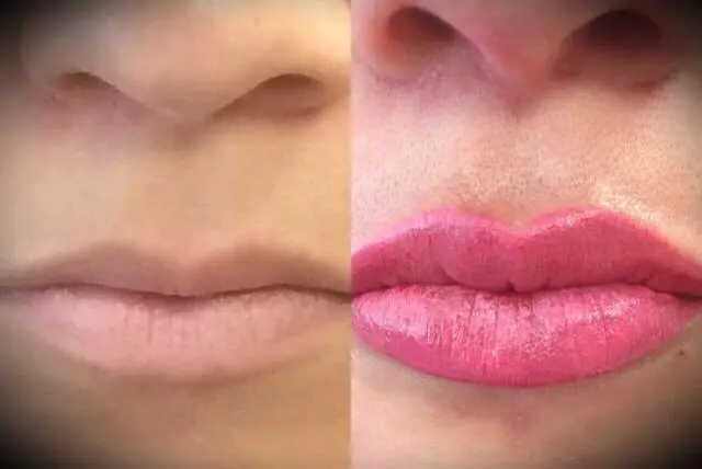 Advanced Medical Aesthetics