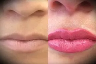 Advanced Medical Aesthetics