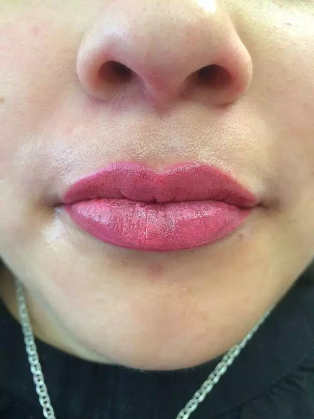 Advanced Medical Aesthetics