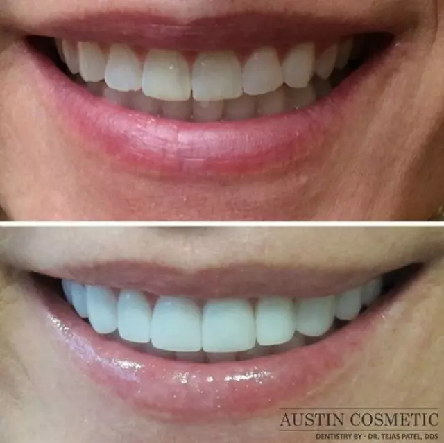 Austin Cosmetic Dentistry by Dr. Tejas Patel, DDS
