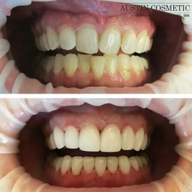 Austin Cosmetic Dentistry by Dr. Tejas Patel, DDS