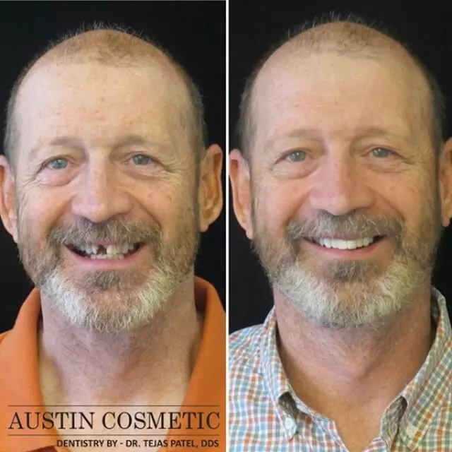 Austin Cosmetic Dentistry by Dr. Tejas Patel, DDS