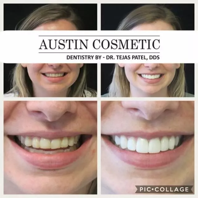 Austin Cosmetic Dentistry by Dr. Tejas Patel, DDS