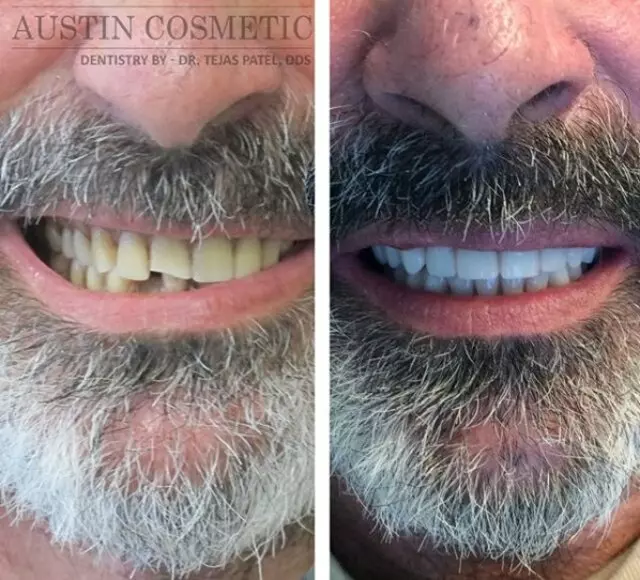 Austin Cosmetic Dentistry by Dr. Tejas Patel, DDS