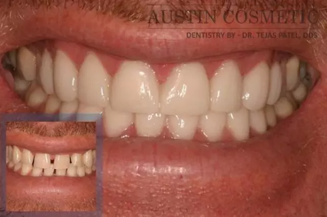 Austin Cosmetic Dentistry by Dr. Tejas Patel, DDS