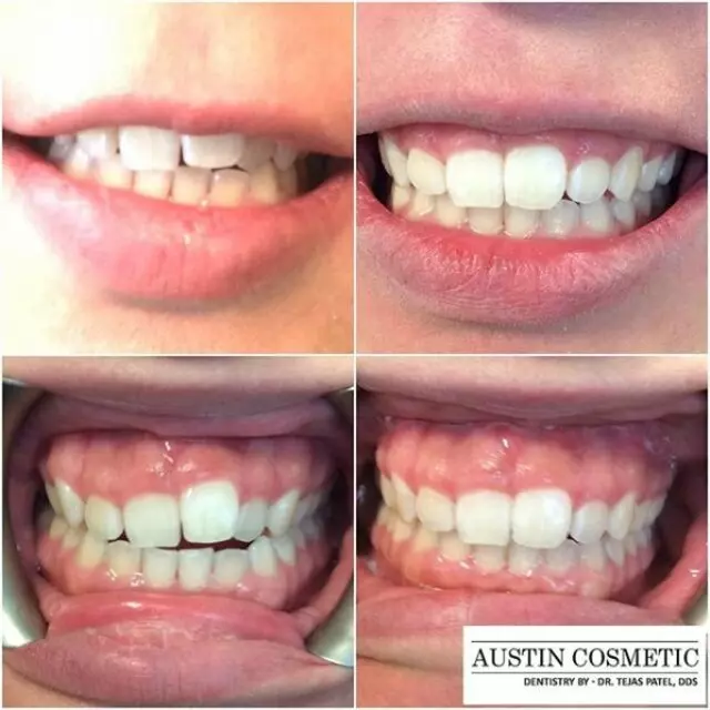 Austin Cosmetic Dentistry by Dr. Tejas Patel, DDS