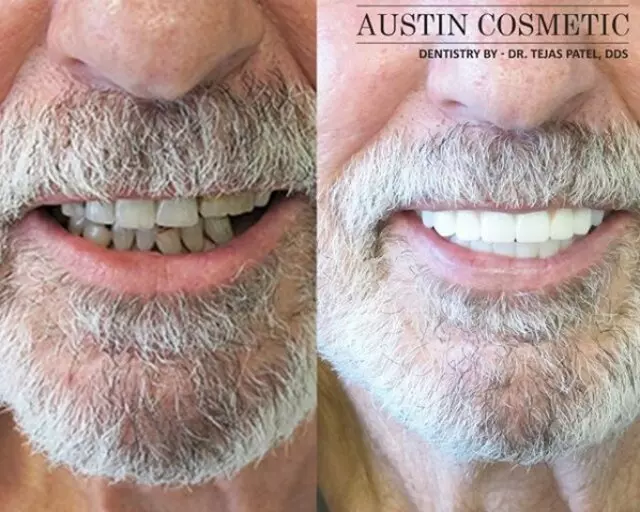 Austin Cosmetic Dentistry by Dr. Tejas Patel, DDS