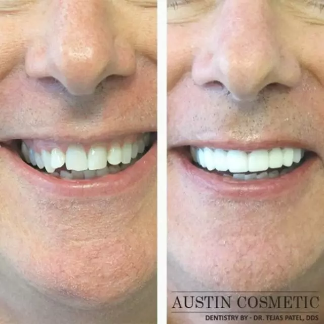 Austin Cosmetic Dentistry by Dr. Tejas Patel, DDS