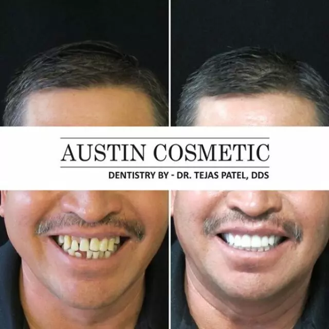 Austin Cosmetic Dentistry by Dr. Tejas Patel, DDS