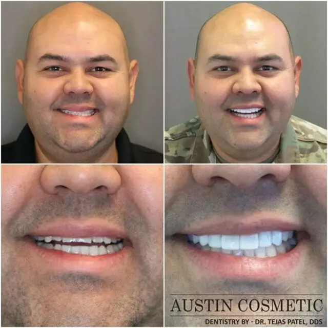 Austin Cosmetic Dentistry by Dr. Tejas Patel, DDS