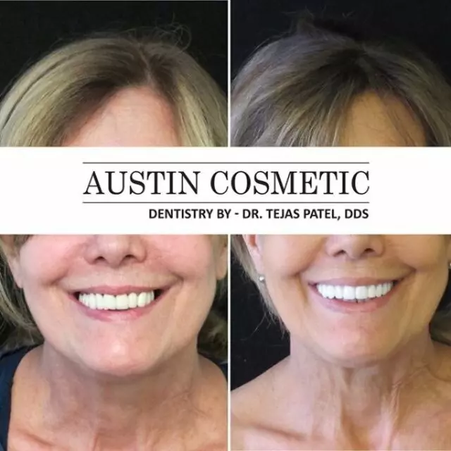 Austin Cosmetic Dentistry by Dr. Tejas Patel, DDS
