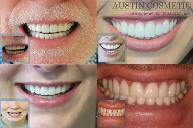 Austin Cosmetic Dentistry by Dr. Tejas Patel, DDS
