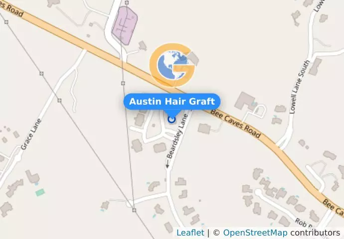 Austin Hair Graft