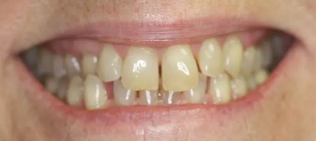 Alpine Dental