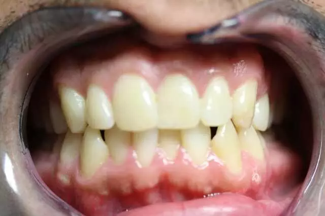 Alpine Dental
