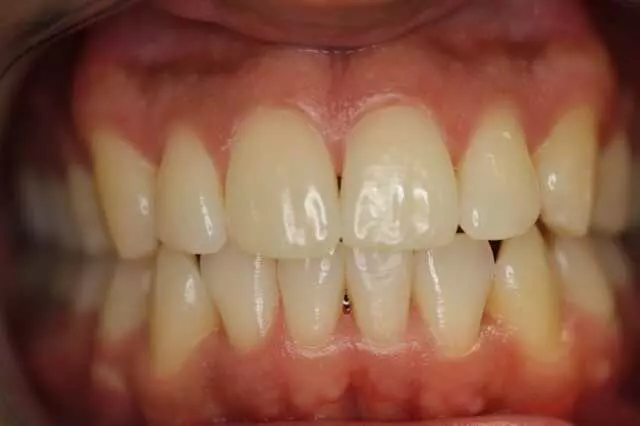 Alpine Dental