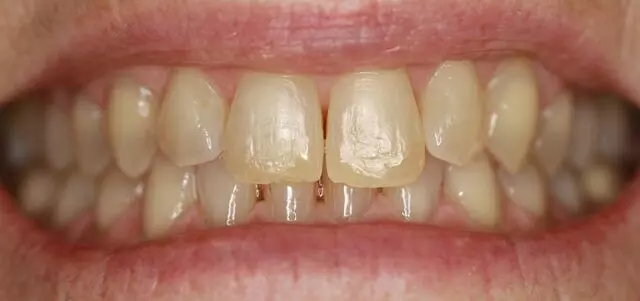 Alpine Dental