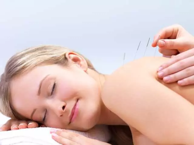 American Acupuncture Project