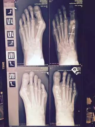 Austin Ankle Associates