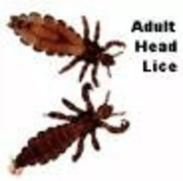 De-Louse