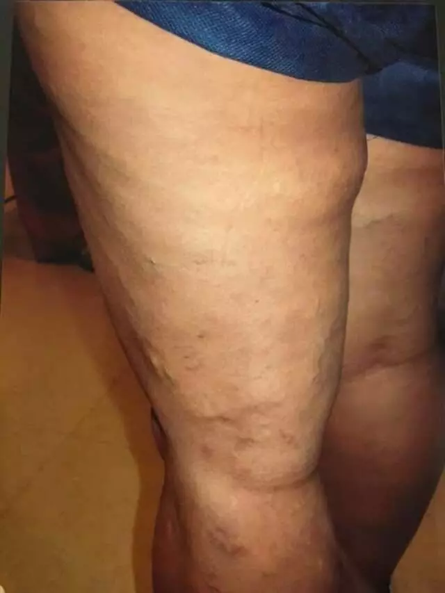 Austin Vein and Vascular Clinic
