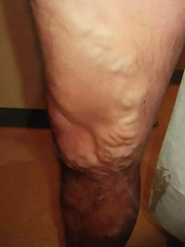 Austin Vein and Vascular Clinic