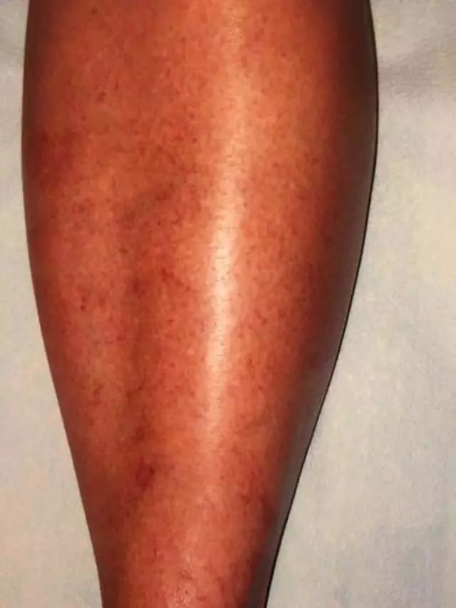 Austin Vein and Vascular Clinic