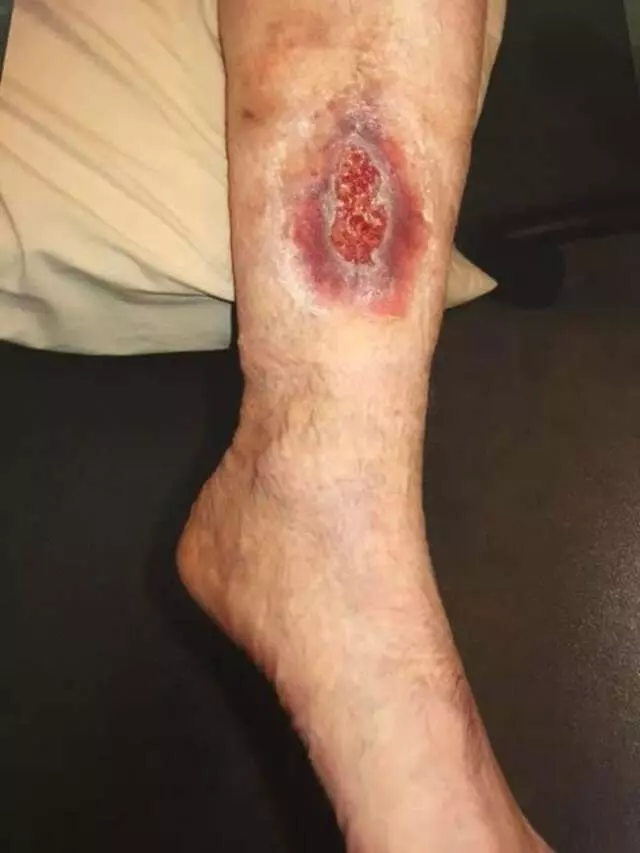 Austin Vein and Vascular Clinic