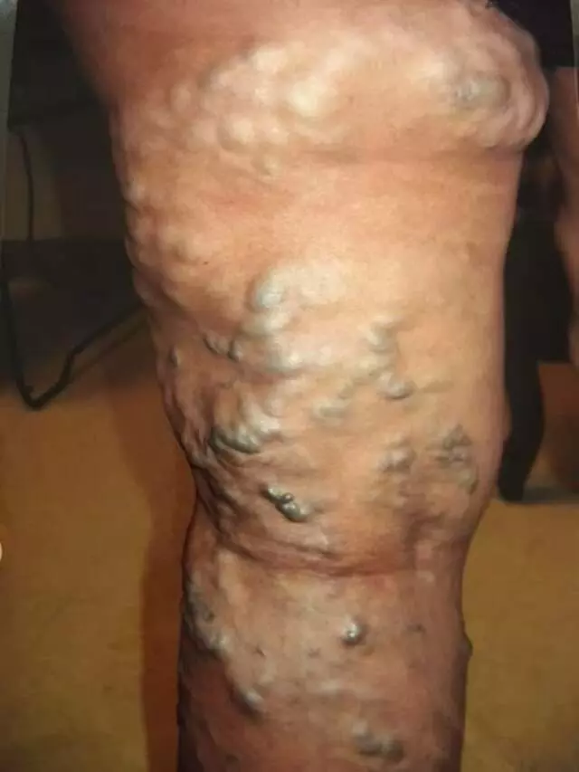 Austin Vein and Vascular Clinic