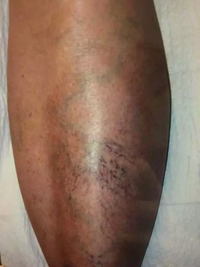 Austin Vein and Vascular Clinic