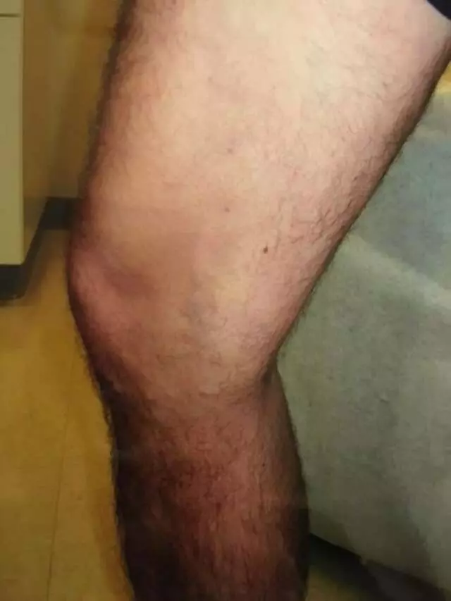 Austin Vein and Vascular Clinic
