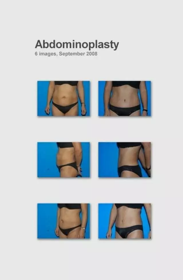 Sanjay Sharma, MD - Plastic Surgery Austin