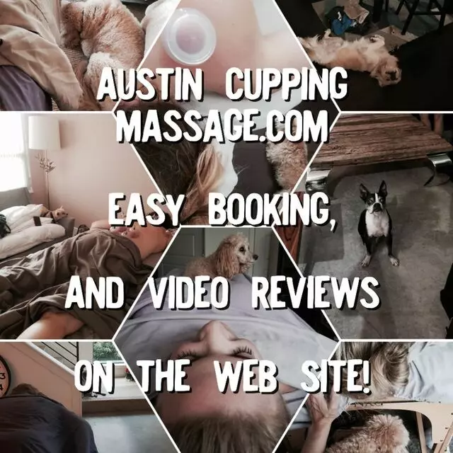 Austin Cupping Massage