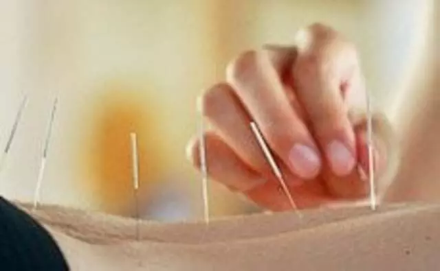 Austin Family Acupuncture