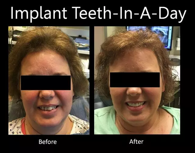 Austin Dental Implant Center