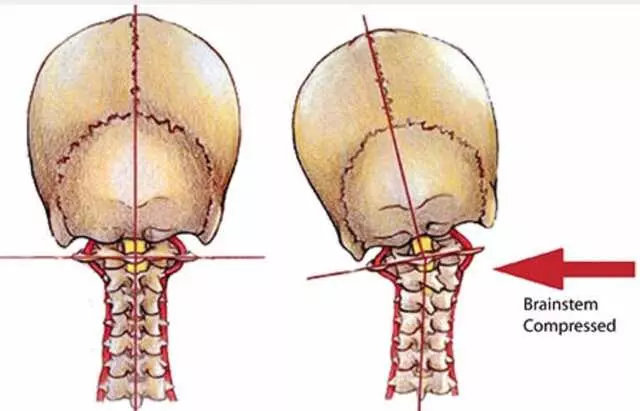 Austin Atlas  Orthogonal  Chiropractic