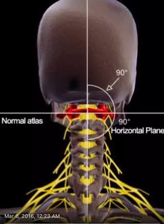 Austin Atlas  Orthogonal  Chiropractic