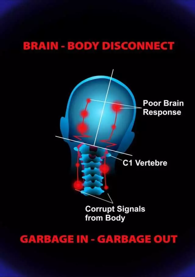Austin Atlas  Orthogonal  Chiropractic
