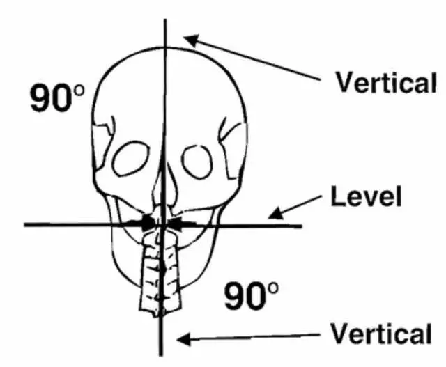 Austin Atlas  Orthogonal  Chiropractic