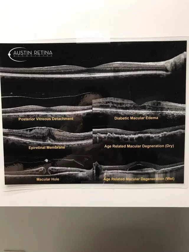 Austin Retina Associates