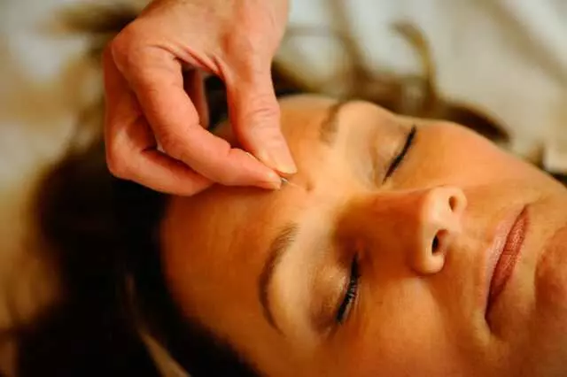Acupuncture Wellness at Whole Body Health