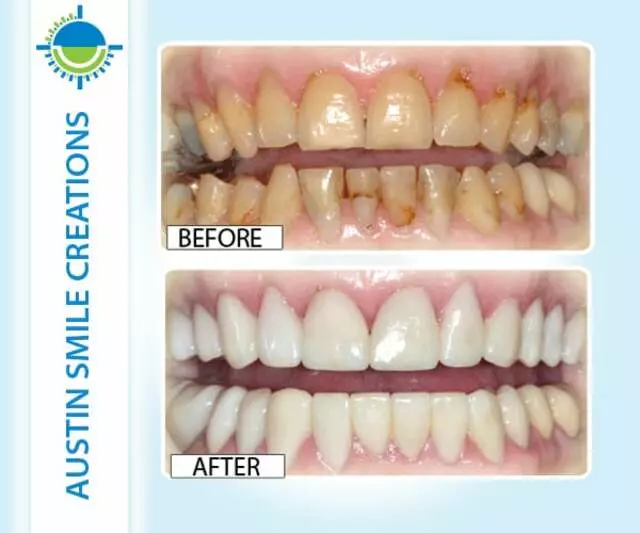 Austin Smile Creations