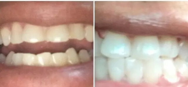 Austin Primary Dental